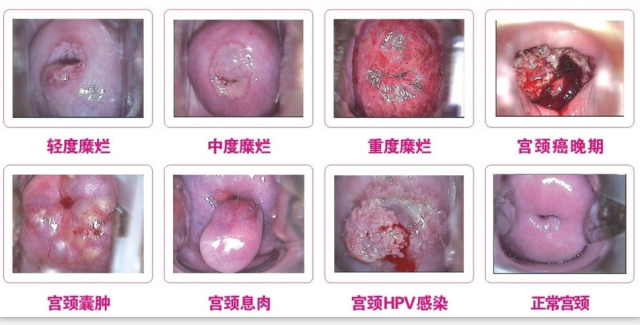 1470203216460009.png blob.png