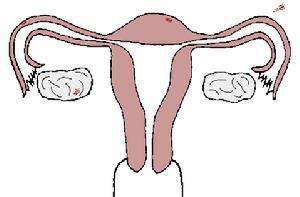 1491891395607135.jpg 附件炎图.jpg